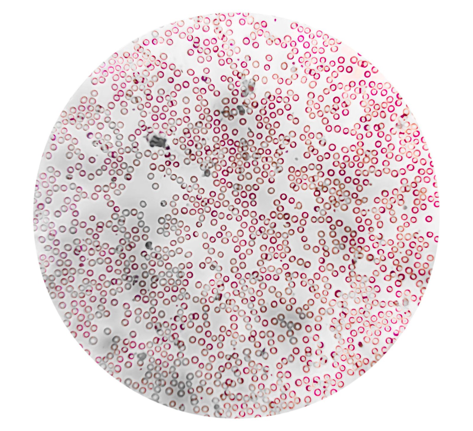 red blood cells viewed under a medical microscope